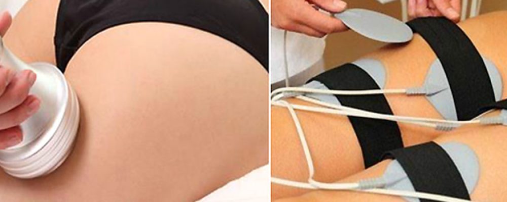 Elektrostimulacija mišića – pasivno vežbanje