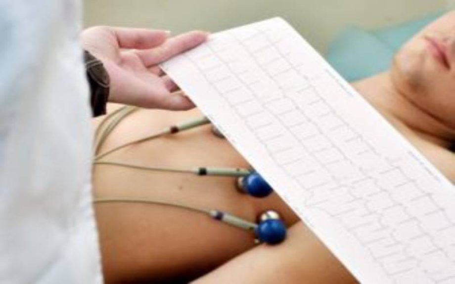 EKG - Ordinacija Cardios Novi Sad