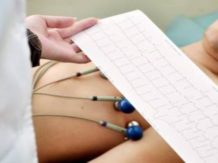 EKG - Ordinacija Cardios Novi Sad