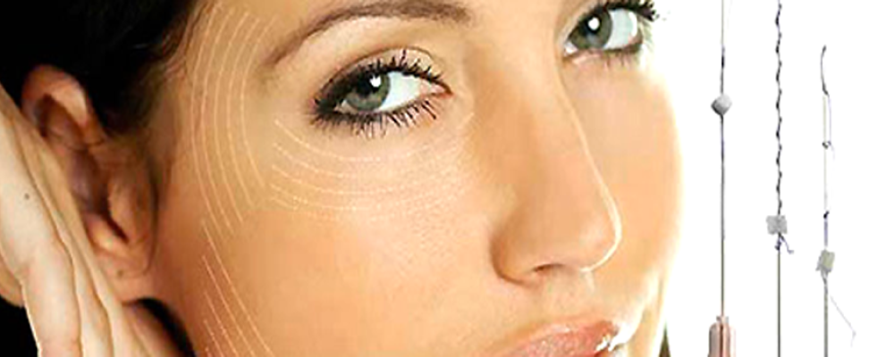 3D mezoniti – neoperativni lifting