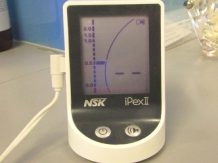 Apex lokalor