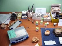 Fasete, krunice i mostovi