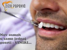 Solo krunice i viniri