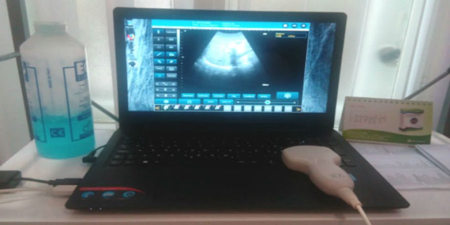 Ultrazvuk abdomena u ordinaciji opšte prakese