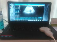 Ultrazvuk abdomena u ordinaciji opšte prakese