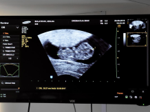 Ultrazvučni pregled