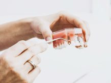 Zubni implantati