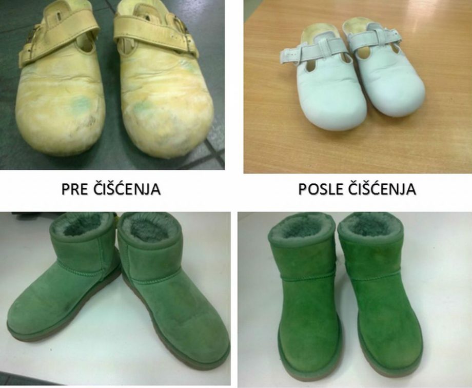 Hemijsko čišćenje obuće